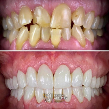 Slider image (3) Dental Artistry Dental Center